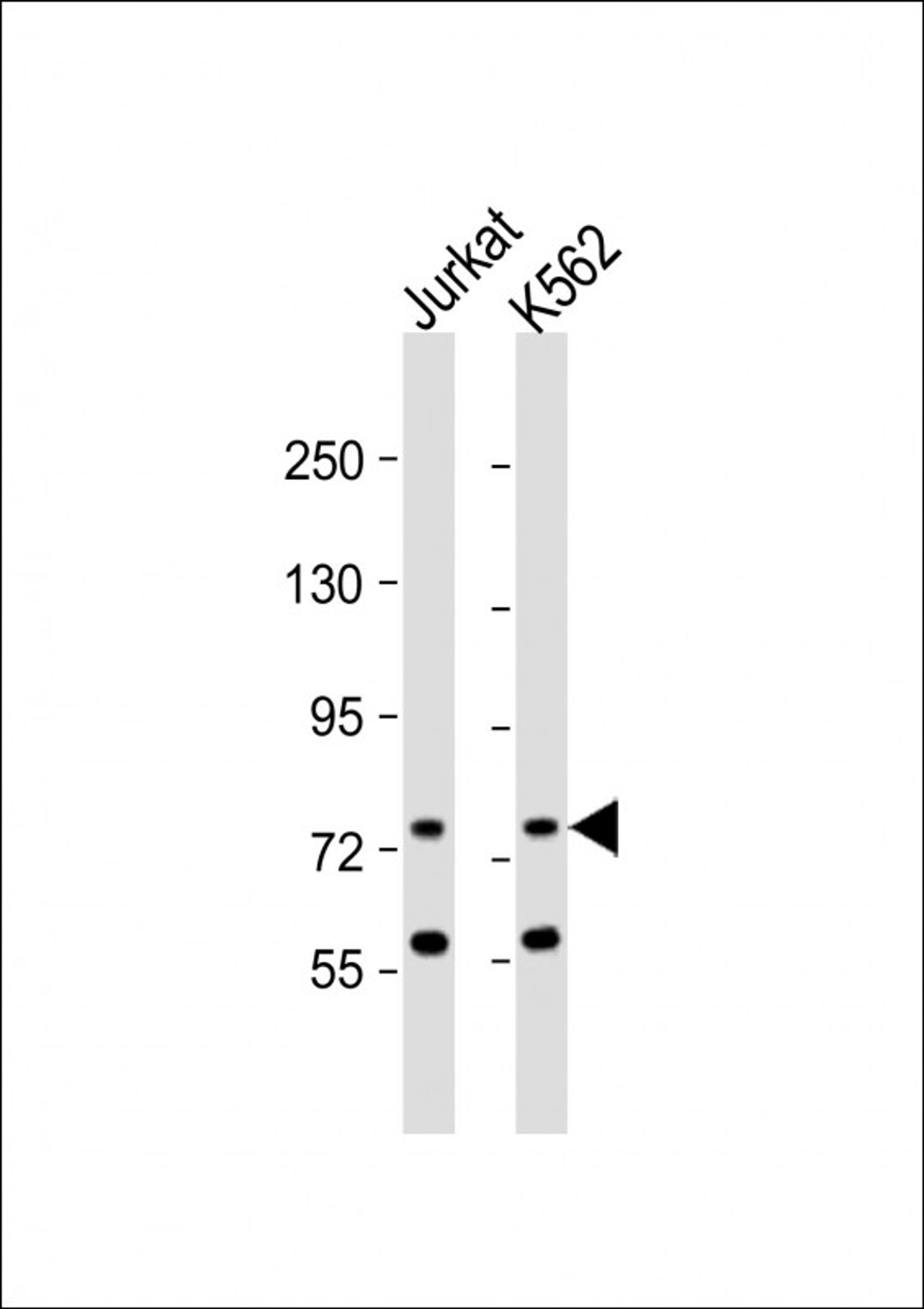 Western Blot at 1:1000 dilution Lane 1: Jurkat whole cell lysate Lane 2: K562 whole cell lysate Lysates/proteins at 20 ug per lane.