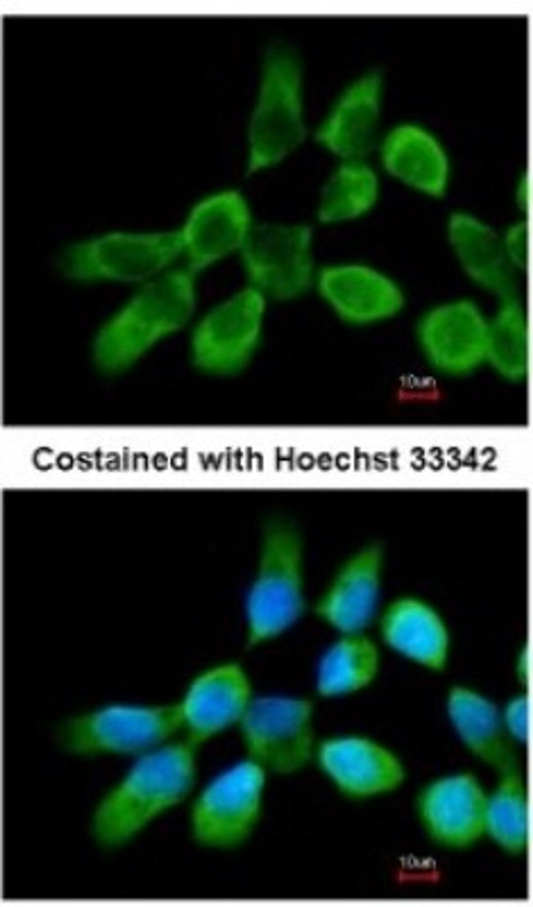 Immunocytochemistry/Immunofluorescence: RPL3 Antibody [NBP2-20214] - Analysis of methanol-fixed A431, using antibody at 1:200 dilution.