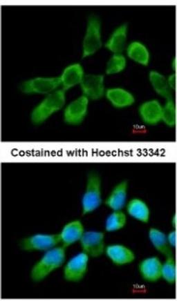 Immunocytochemistry/Immunofluorescence: RPL3 Antibody [NBP2-20214] - Analysis of methanol-fixed A431, using antibody at 1:200 dilution.