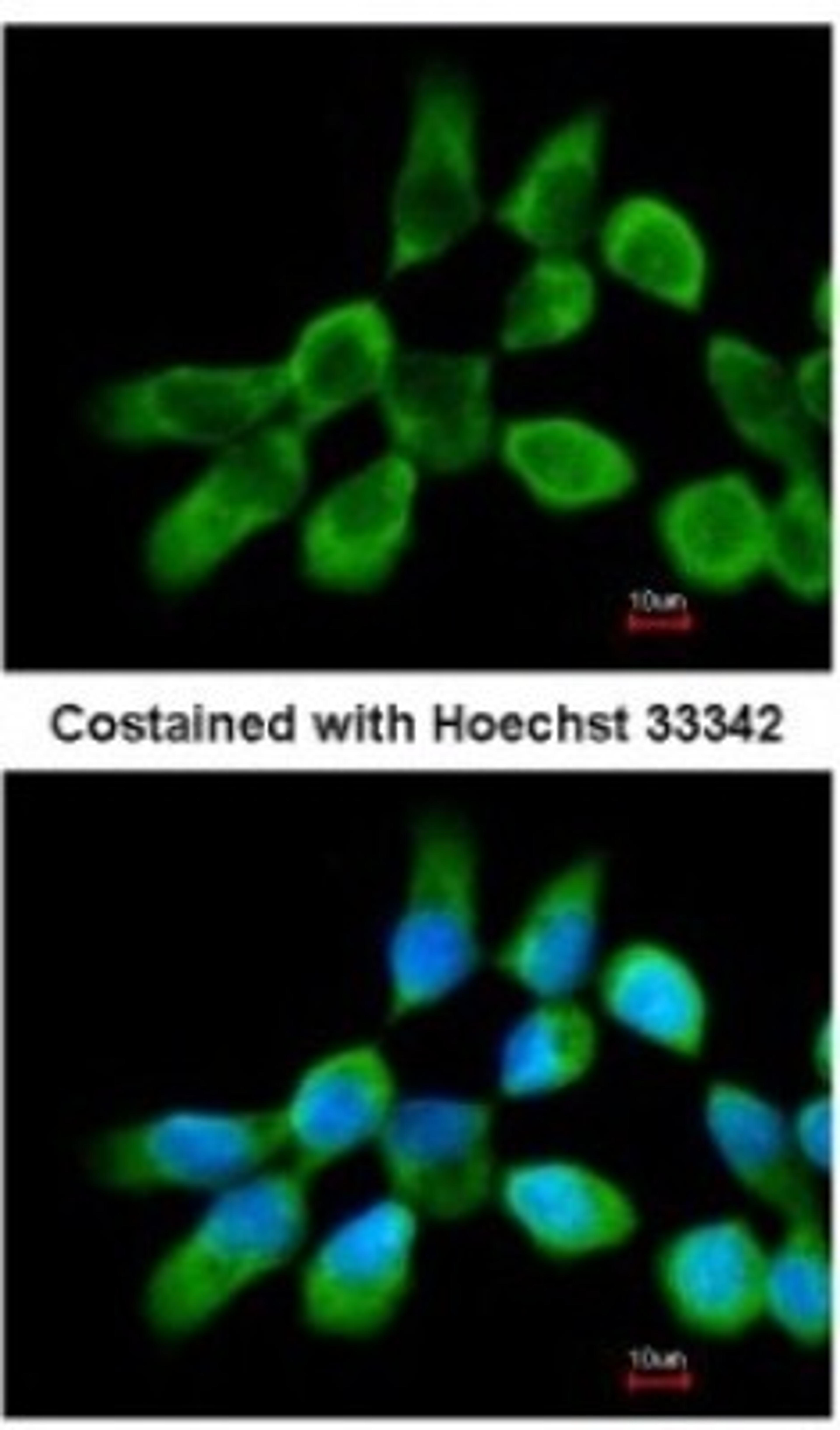 Immunocytochemistry/Immunofluorescence: RPL3 Antibody [NBP2-20214] - Analysis of methanol-fixed A431, using antibody at 1:200 dilution.