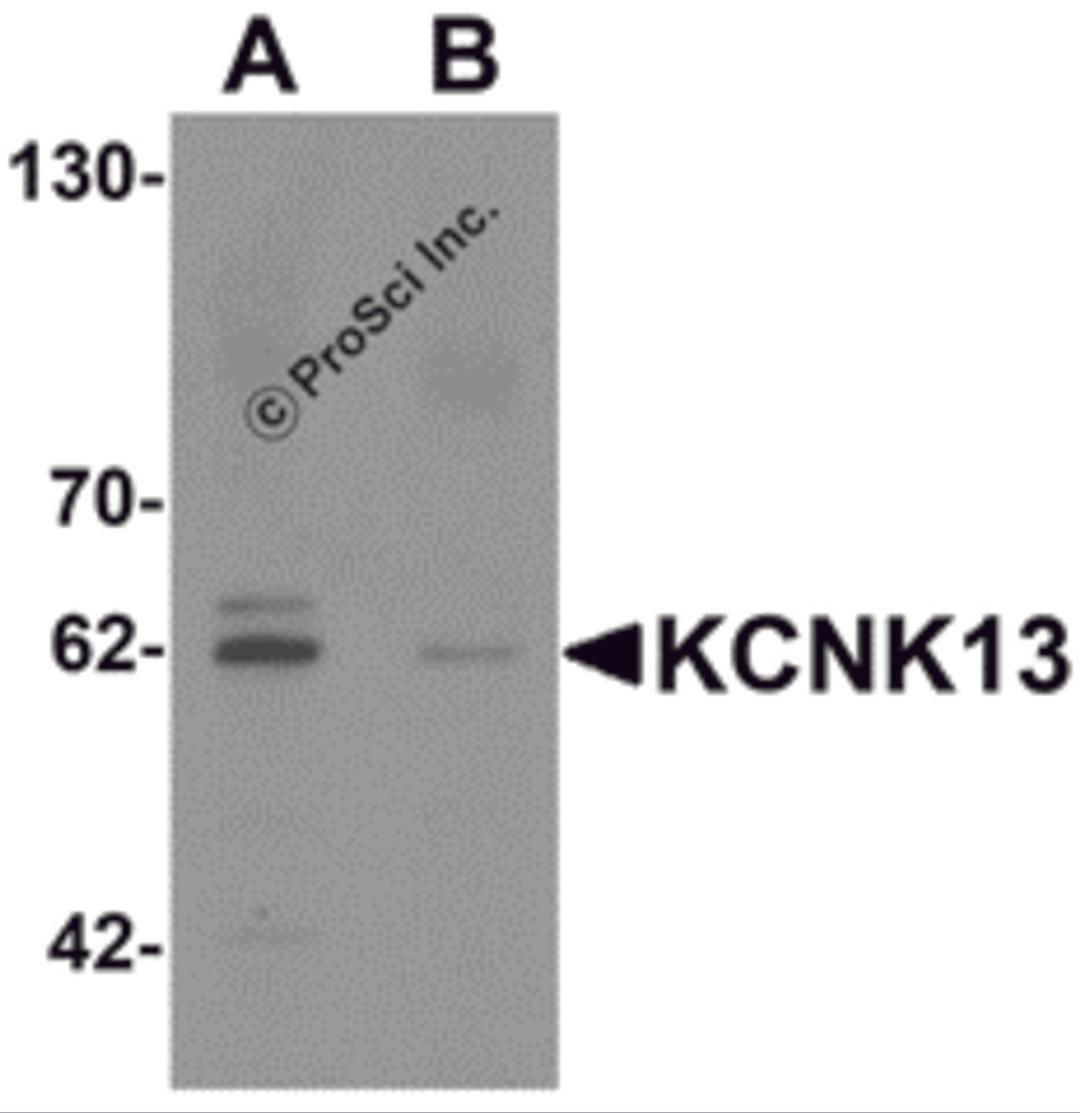 Western blot analysis of KCNK13 in rat brain tissue lysate with KCNK13 antibody at 0.5 &#956;g/mL in (A) the absence and (B) the presence of blocking peptide.