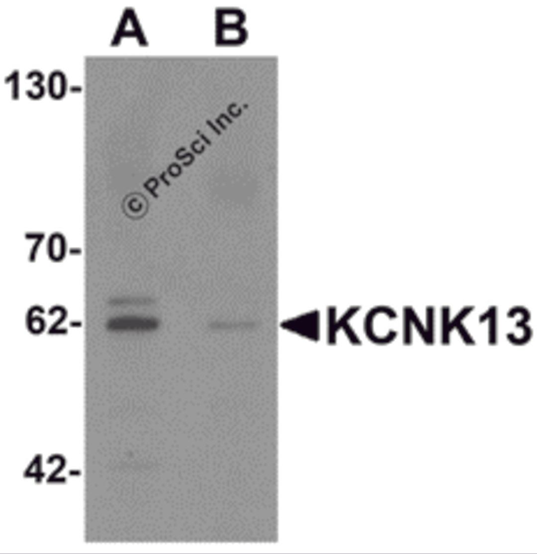 Western blot analysis of KCNK13 in rat brain tissue lysate with KCNK13 antibody at 0.5 μg/mL in (A) the absence and (B) the presence of blocking peptide.