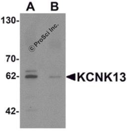 Western blot analysis of KCNK13 in rat brain tissue lysate with KCNK13 antibody at 0.5 μg/mL in (A) the absence and (B) the presence of blocking peptide.