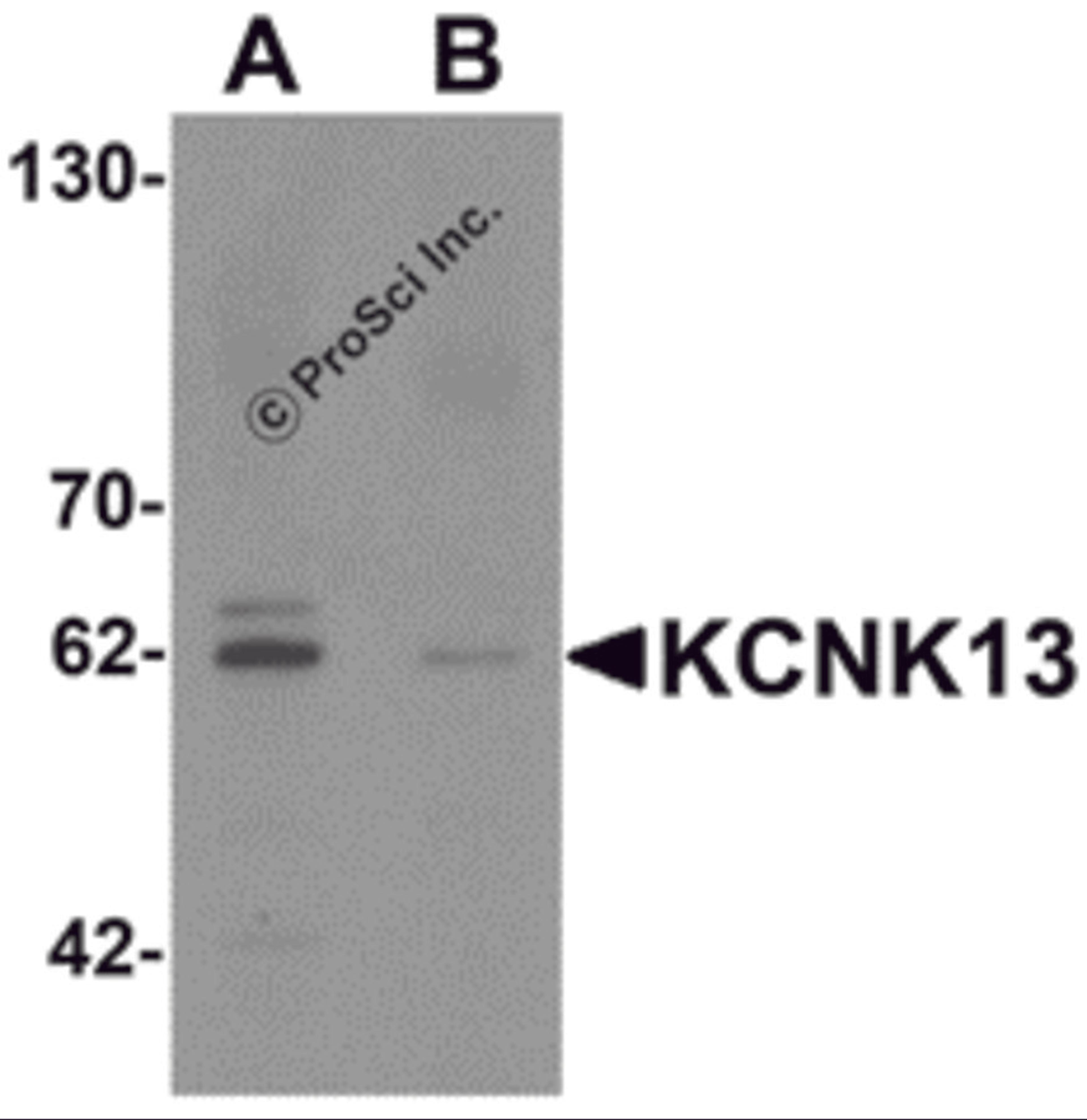 Western blot analysis of KCNK13 in rat brain tissue lysate with KCNK13 antibody at 0.5 μg/mL in (A) the absence and (B) the presence of blocking peptide.