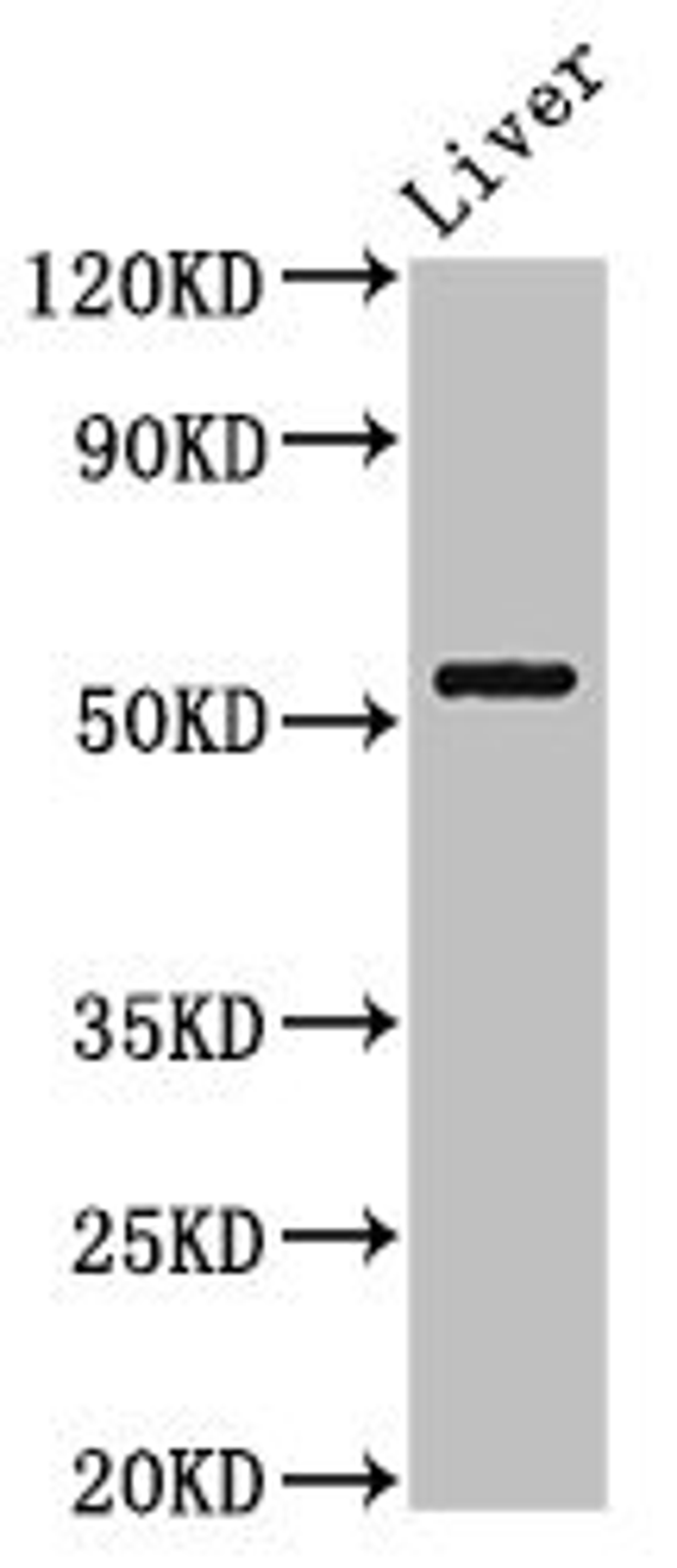 Western Blot. Positive WB detected in: Mouse liver tissue. All lanes: MEIS2 antibody at 3ug/ml. Secondary. Goat polyclonal to rabbit IgG at 1/50000 dilution. Predicted band size: 52, 44, 33, 34, 42, 43 kDa. Observed band size: 52 kDa.