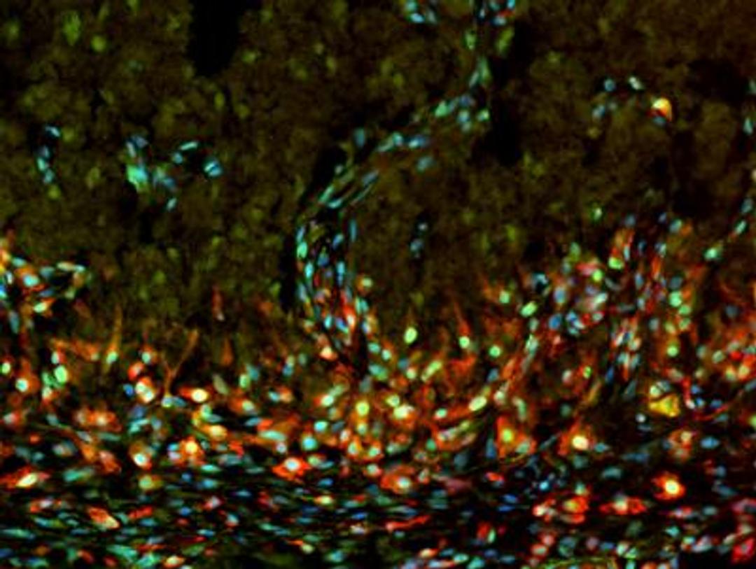 Immunohistochemistry-Frozen: PCNA Antibody (PC10) [NB500-106] - IHC analysis of a paraformaldehyde fixed frozen section of brain from murine embryo using PCNA antibody clone PC10 (green), an IB4 antibody (red) and DAPI. Image provided by Dr Siegenthaler via product review.