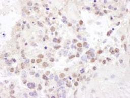 Detection of mouse NF90 and NF110 by immunohistochemistry.