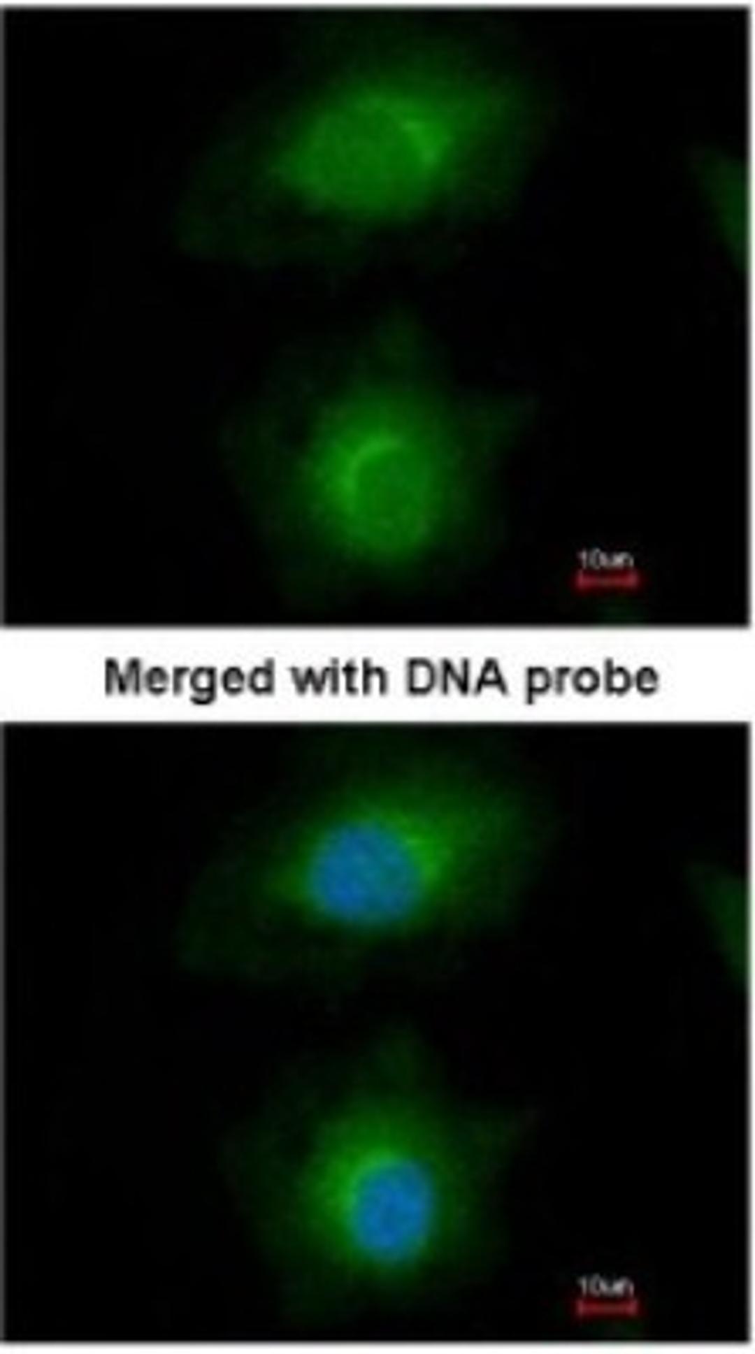 Immunocytochemistry/Immunofluorescence: MVD Antibody [NBP1-33050] - Paraformaldehyde-fixed HeLa, using antibody at 1:200 dilution.