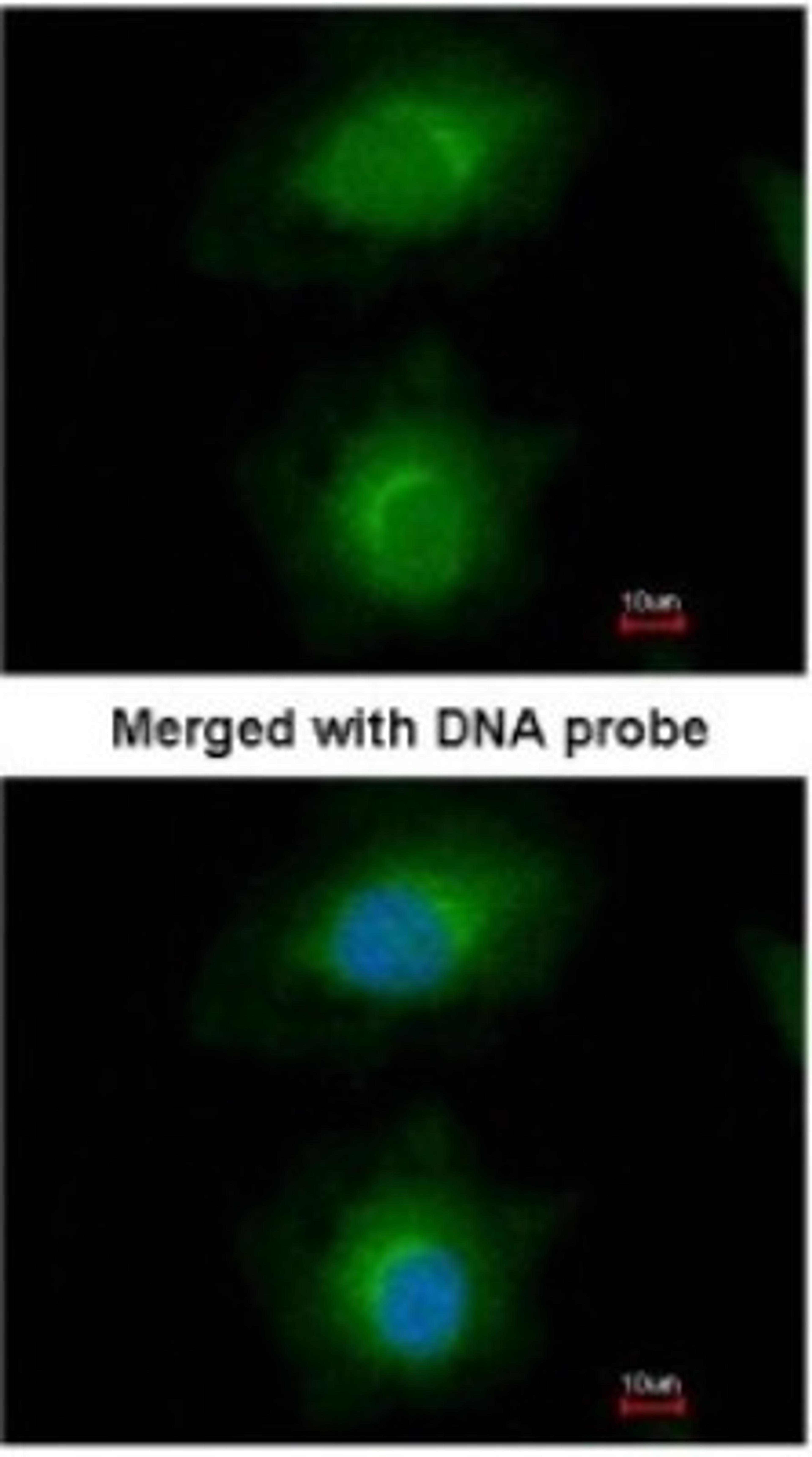 Immunocytochemistry/Immunofluorescence: MVD Antibody [NBP1-33050] - Paraformaldehyde-fixed HeLa, using antibody at 1:200 dilution.