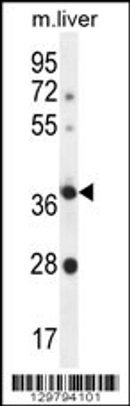 Western blot analysis in mouse liver tissue lysates (35ug/lane).