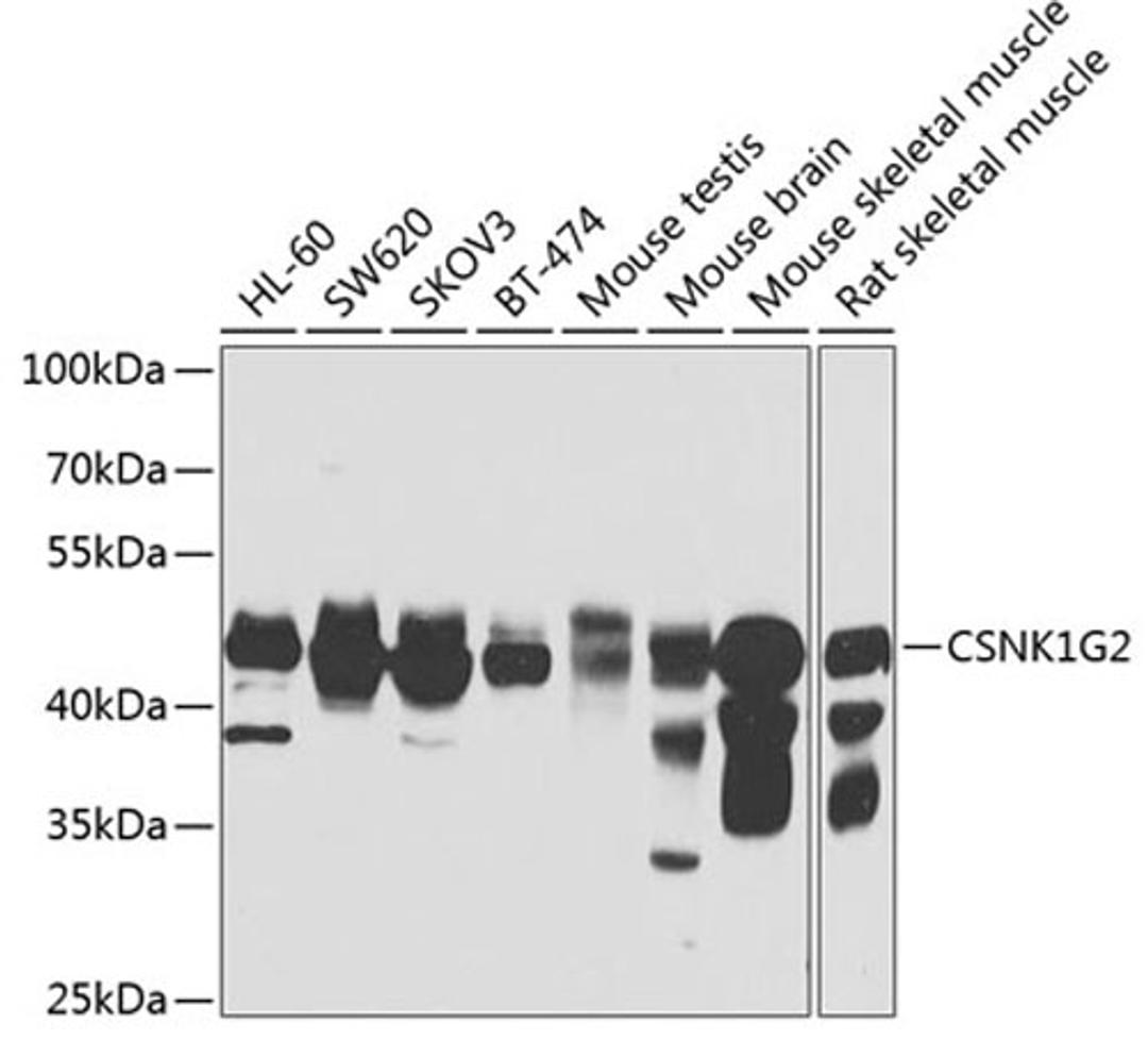 Western blot - CSNK1G2 antibody (A7326)