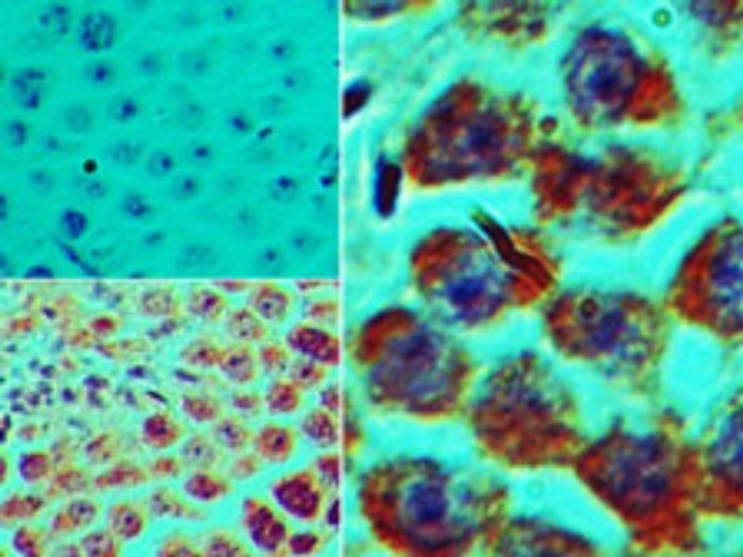 Immunohistochemistry-Paraffin: SPZ1 Antibody [NBP2-24582] - Analysis of SPZ1 in formalin-fixed, paraffin-embedded mouse testis tissue using an isotype control (top left) and this antibody (bottom left, right) at 5 ug/ml.