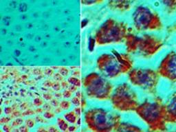 Immunohistochemistry-Paraffin: SPZ1 Antibody [NBP2-24582] - Analysis of SPZ1 in formalin-fixed, paraffin-embedded mouse testis tissue using an isotype control (top left) and this antibody (bottom left, right) at 5 ug/ml.