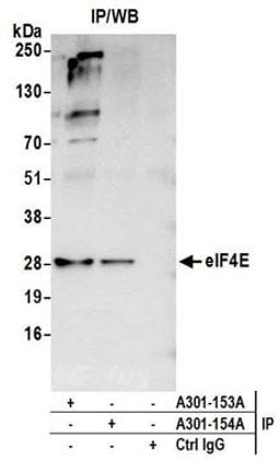 Detection of human eIF4E by western blot of immunoprecipitates.