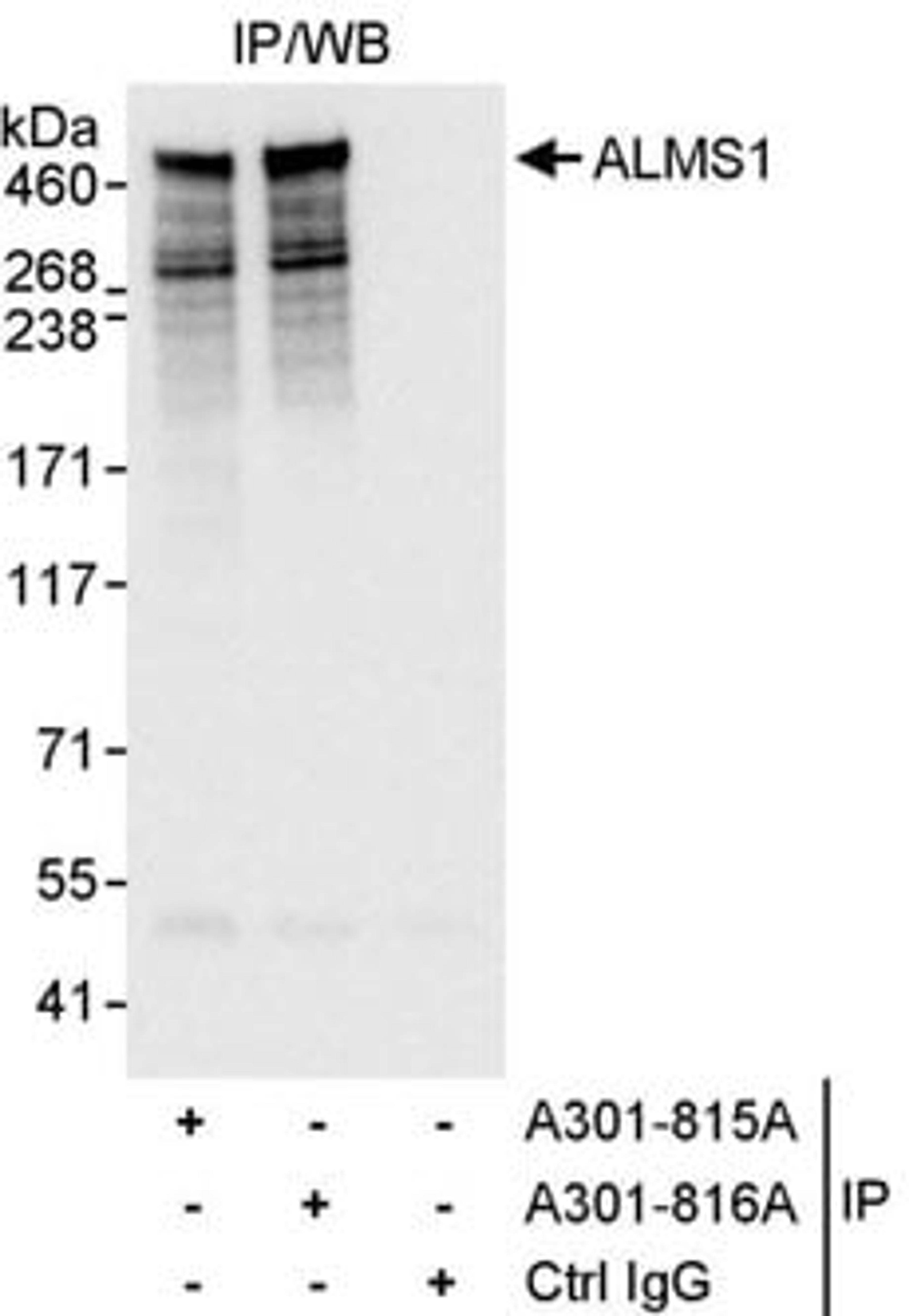 Detection of human ALMS1 by western blot of immunoprecipitates.