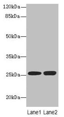 Western blot. All lanes: EEF1AKMT1 antibody at 10µg/ml. Lane 1: Jurkat whole cell lysate. Lane 2: 293T whole cell lysate. Secondary. Goat polyclonal to rabbit IgG at 1/10000 dilution. Predicted band size: 25 kDa. Observed band size: 25 kDa