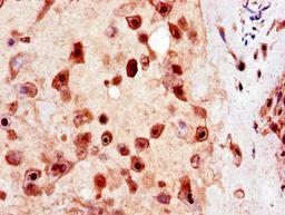 Immunohistochemistry of paraffin-embedded human placenta tissue using CSB-PA883400LA01HU at dilution of 1:100