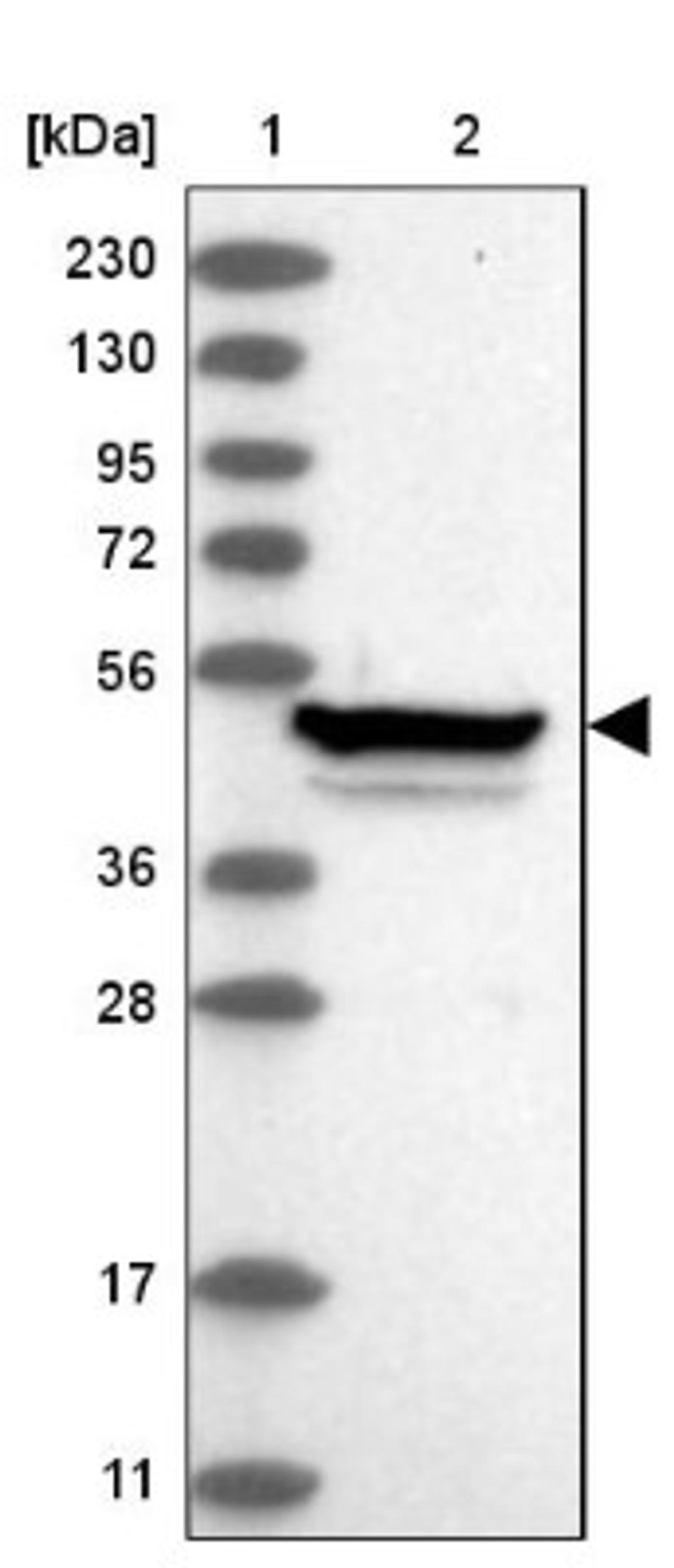 Western Blot: Zinc finger protein 774 Antibody [NBP1-92617] - Lane 1: Marker [kDa] 230, 130, 95, 72, 56, 36, 28, 17, 11<br/>Lane 2: Human cell line RT-4