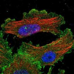 Immunocytochemistry/Immunofluorescence: Yes Antibody [NBP1-85369] -  Staining of human cell line U-251MG shows positivity in plasma membrane & cytoplasm.