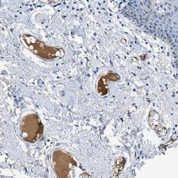 Immunohistochemistry-Paraffin: Apolipoprotein L1 Antibody [NBP1-89033] - Staining of human vulva/anal skin shows distinct positivity in plasma.