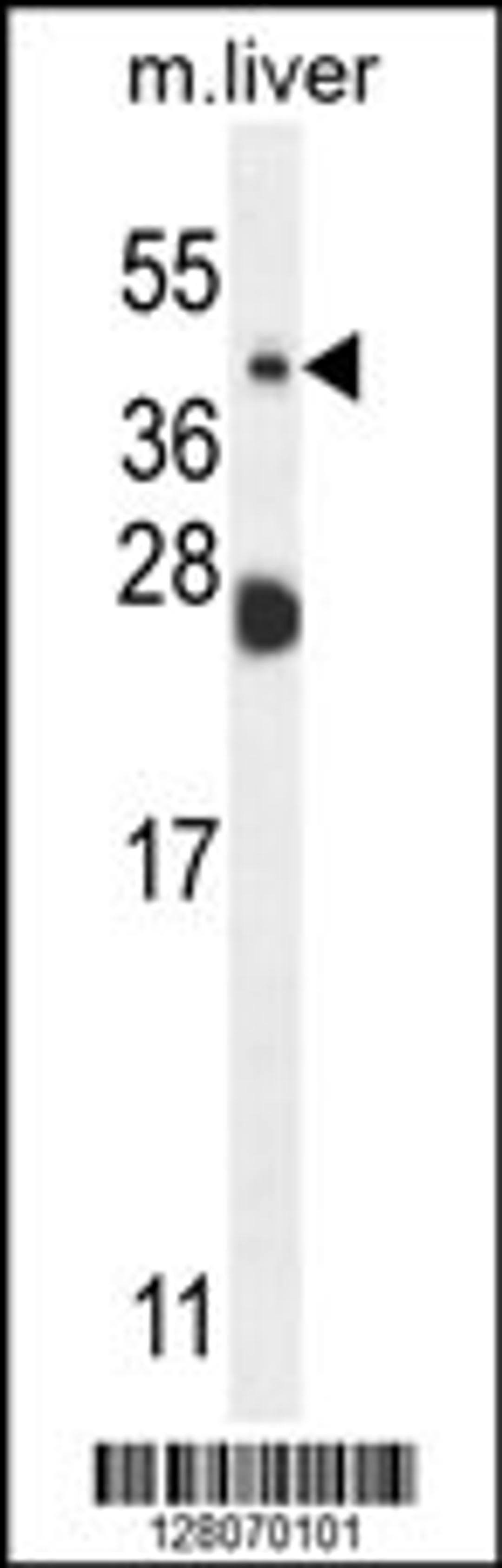 Western blot analysis in mouse liver tissue lysates (35ug/lane).