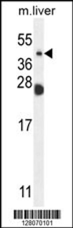 Western blot analysis in mouse liver tissue lysates (35ug/lane).