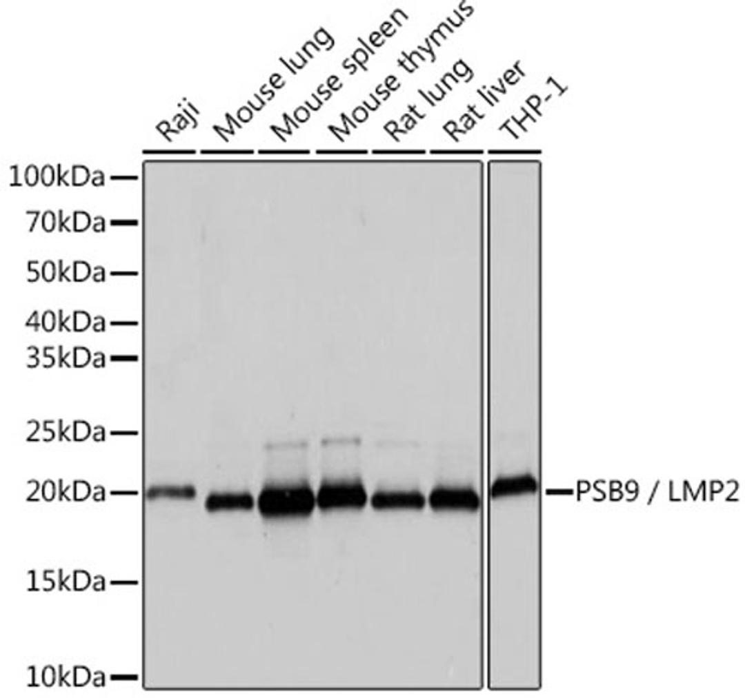 Western blot - PSB9 / LMP2 Rabbit mAb (A9549)