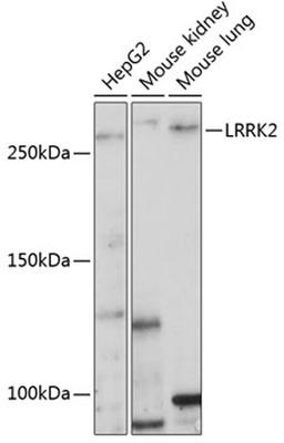 Western blot - LRRK2 Polyclonal Antibody (A17253)