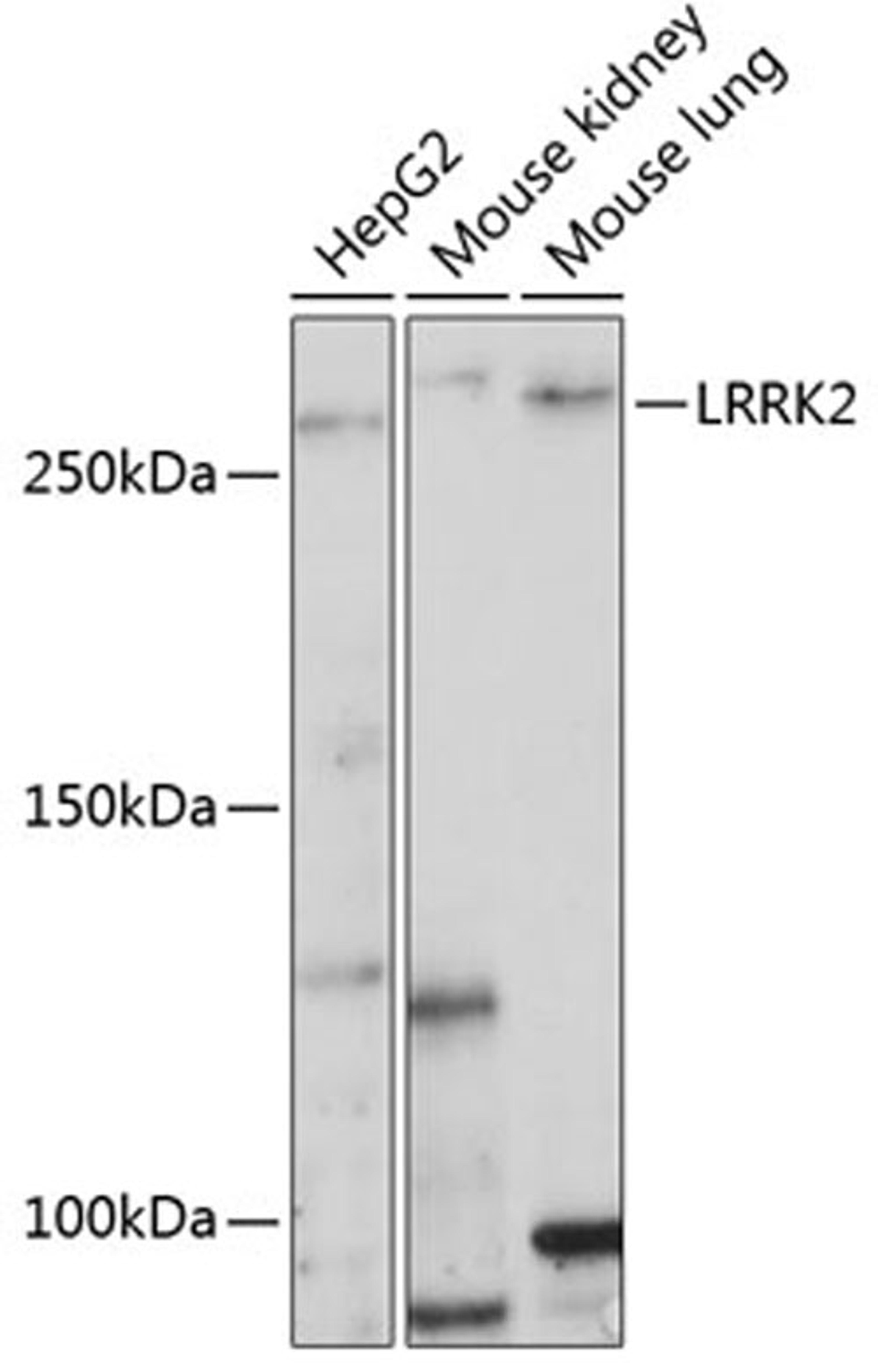 Western blot - LRRK2 Polyclonal Antibody (A17253)