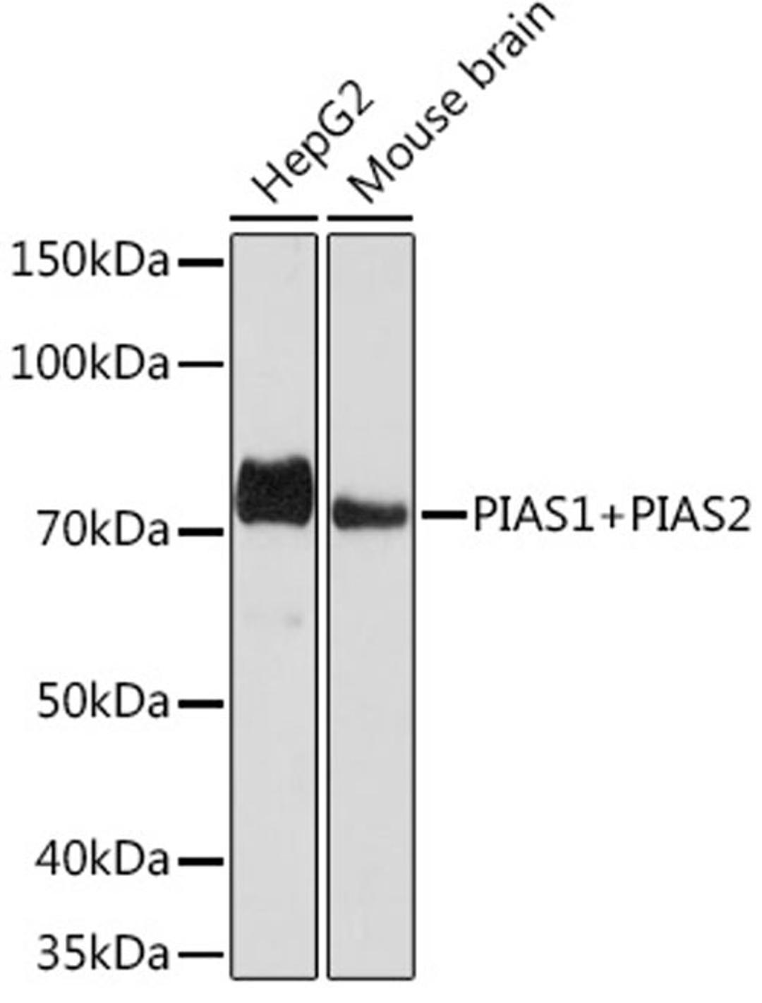 Western blot - PIAS1+PIAS2 Rabbit mAb (A9670)