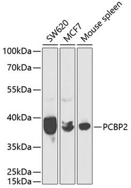 Western blot - PCBP2 antibody (A2531)