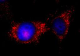 Detection of human ILK by immunocytochemistry.