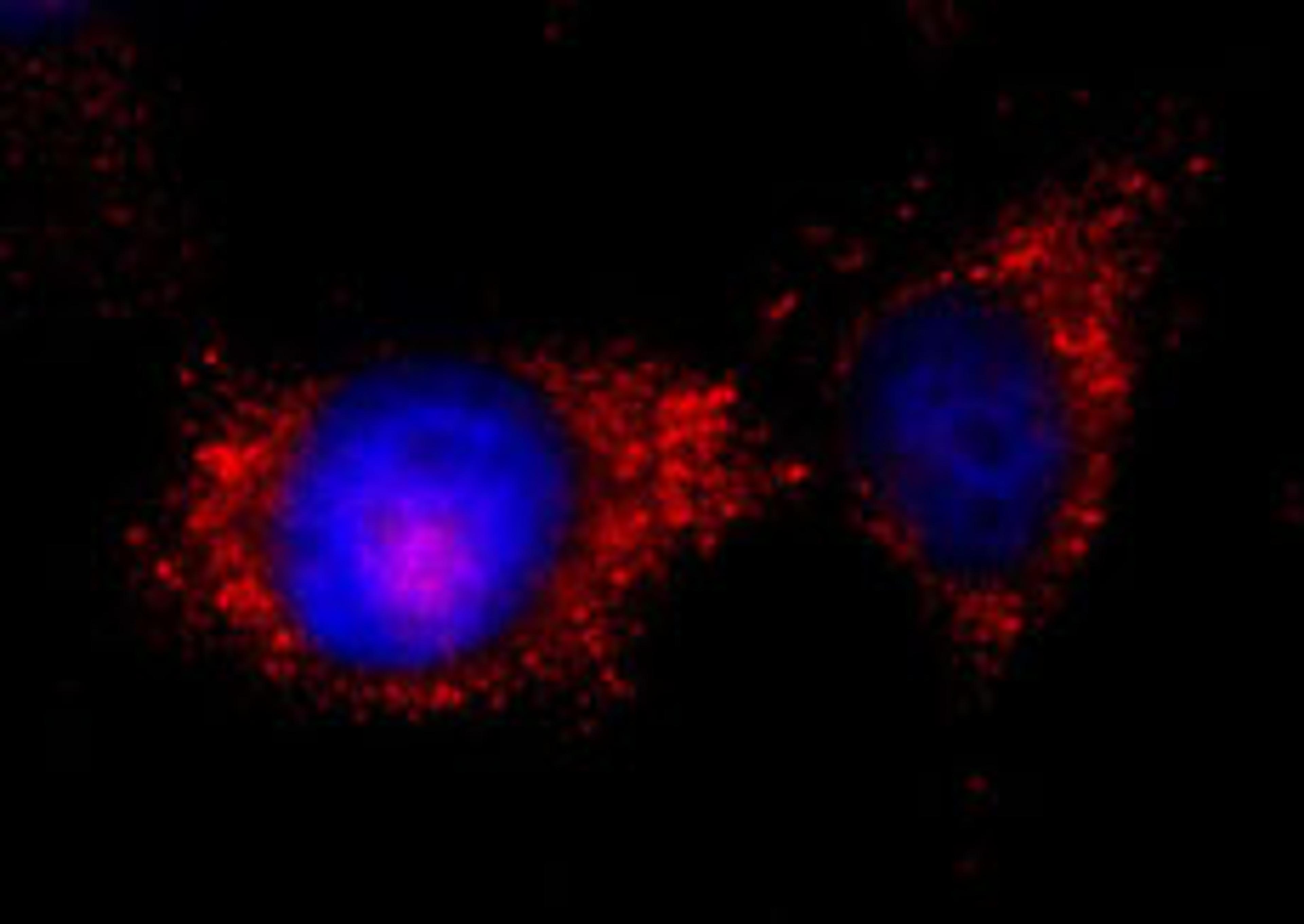 Detection of human ILK by immunocytochemistry.