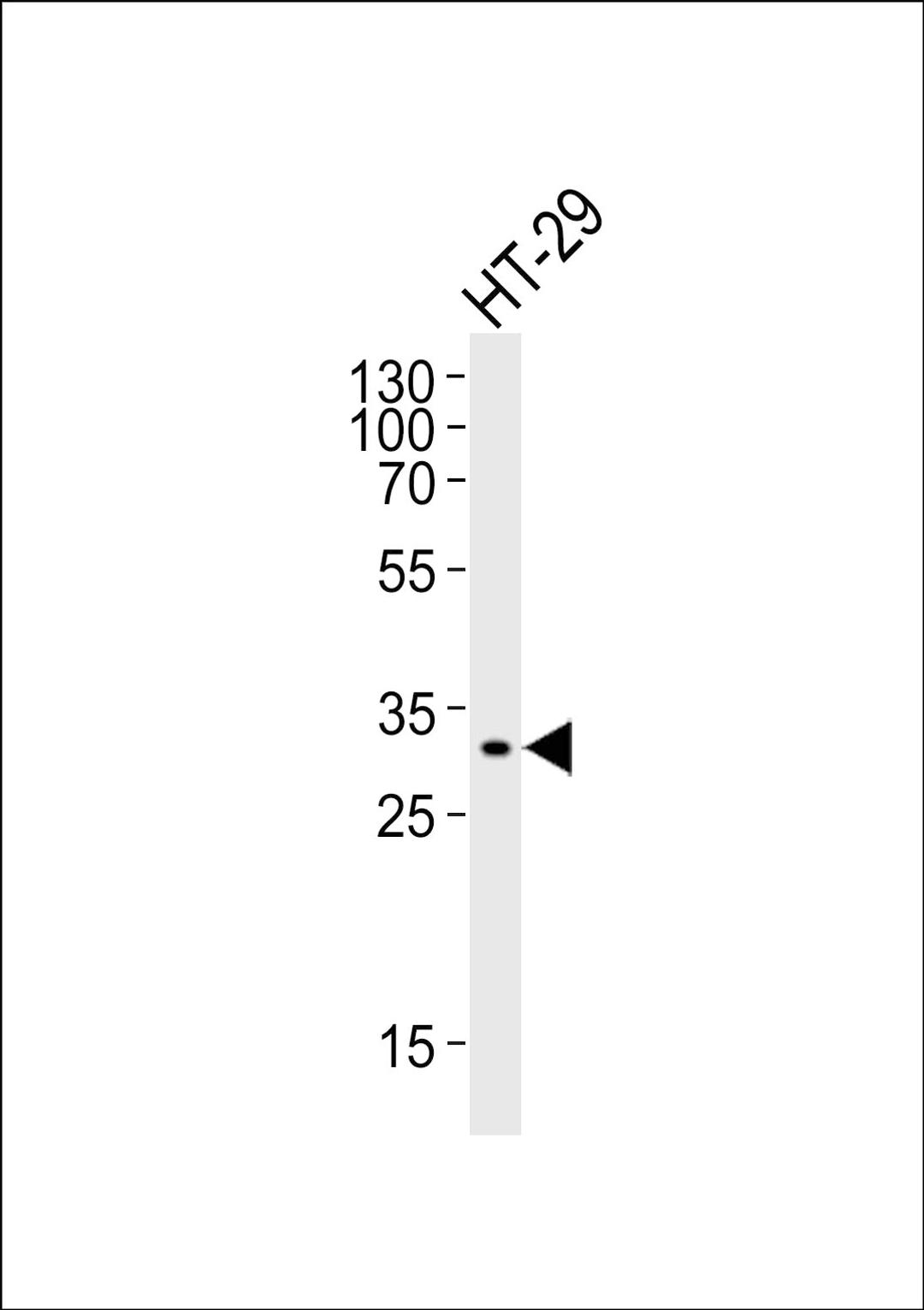 Western blot analysis of lysate from HT-29 cell line, using SMYD3 Antibody at 1:1000.