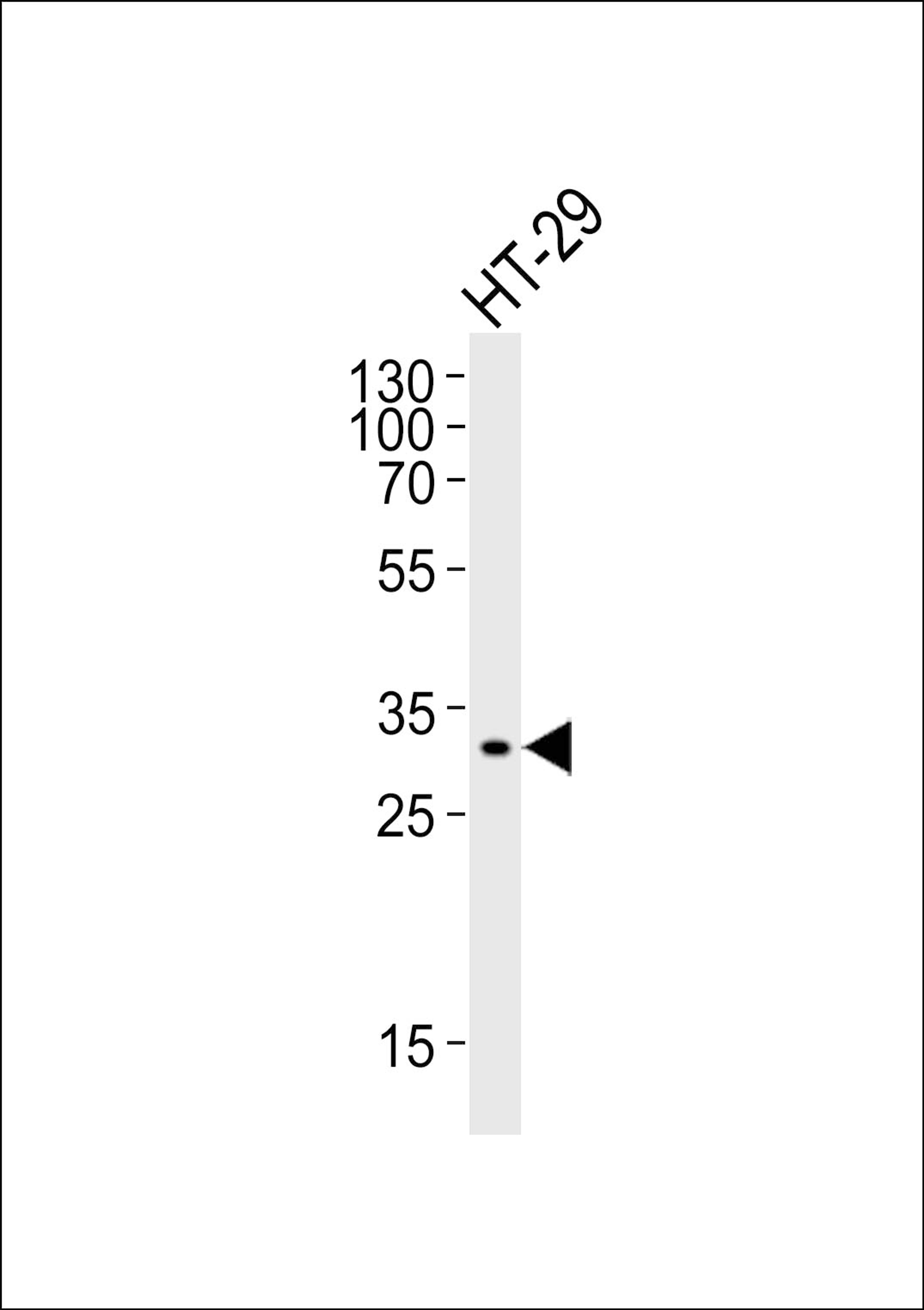 Western blot analysis of lysate from HT-29 cell line, using SMYD3 Antibody at 1:1000.