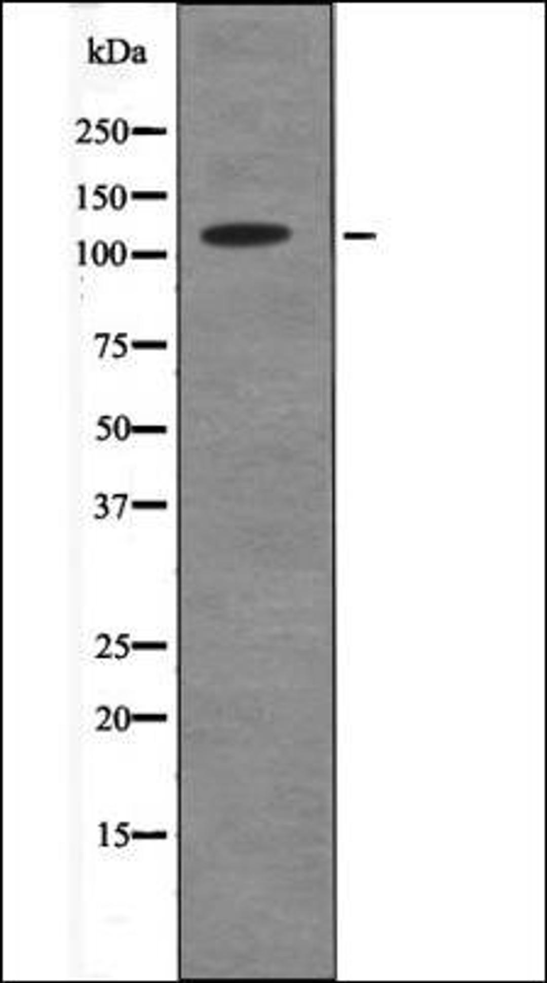 Western blot analysis of Mouse hearttissue lysates using ANKRD28 -Phospho-Ser1040- antibody