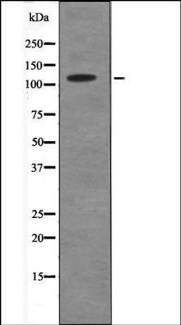 Western blot analysis of Mouse hearttissue lysates using ANKRD28 -Phospho-Ser1040- antibody