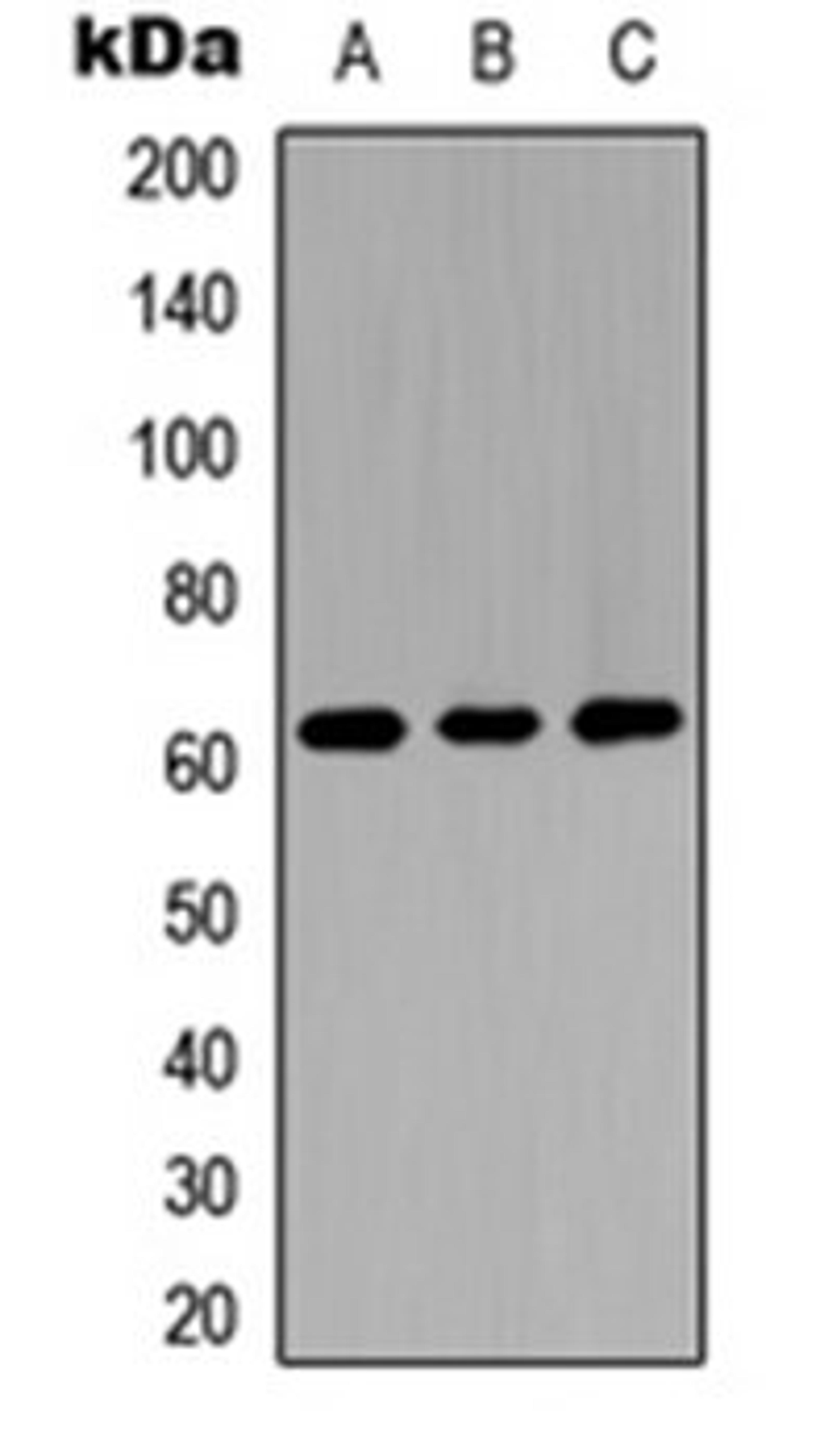 Western blot analysis of A549 (Lane 1), NS-1 (Lane 2), H9C2 (Lane 3) whole cell lysates using GGT5 HC antibody