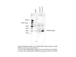 Western Blot: TMPRSS4 Antibody [NBP1-56991] - Human breast cancer cell line SKBR3 and Positive control. Image from verified customer review.