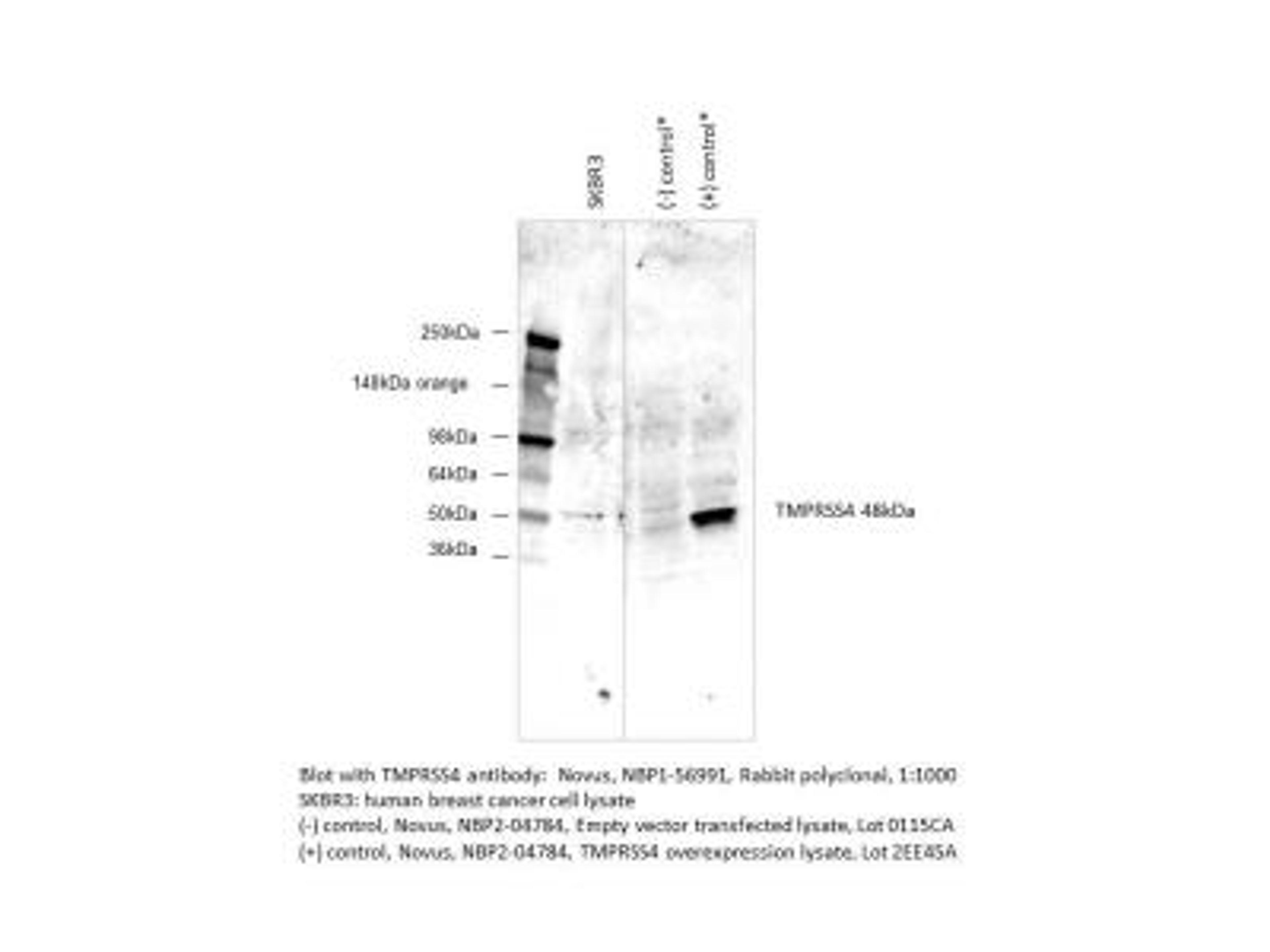 Western Blot: TMPRSS4 Antibody [NBP1-56991] - Human breast cancer cell line SKBR3 and Positive control. Image from verified customer review.