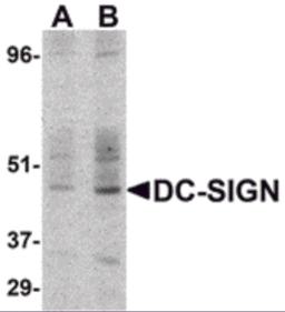 Western blot detection of DC-SIGN in human small intestine at (A) 1 and (B) 2 &#956;g /ml. 