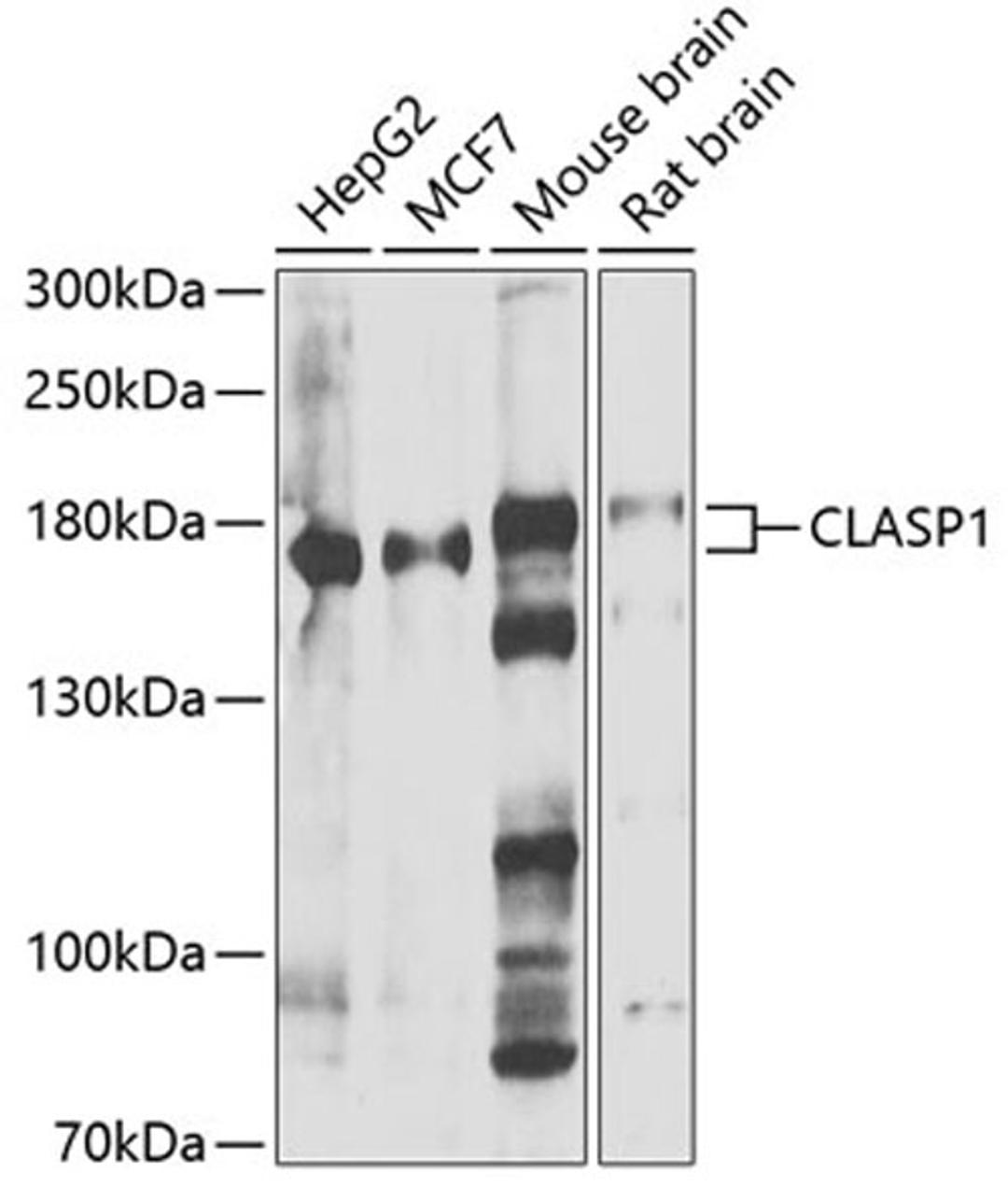 Western blot - CLASP1 antibody (A7081)