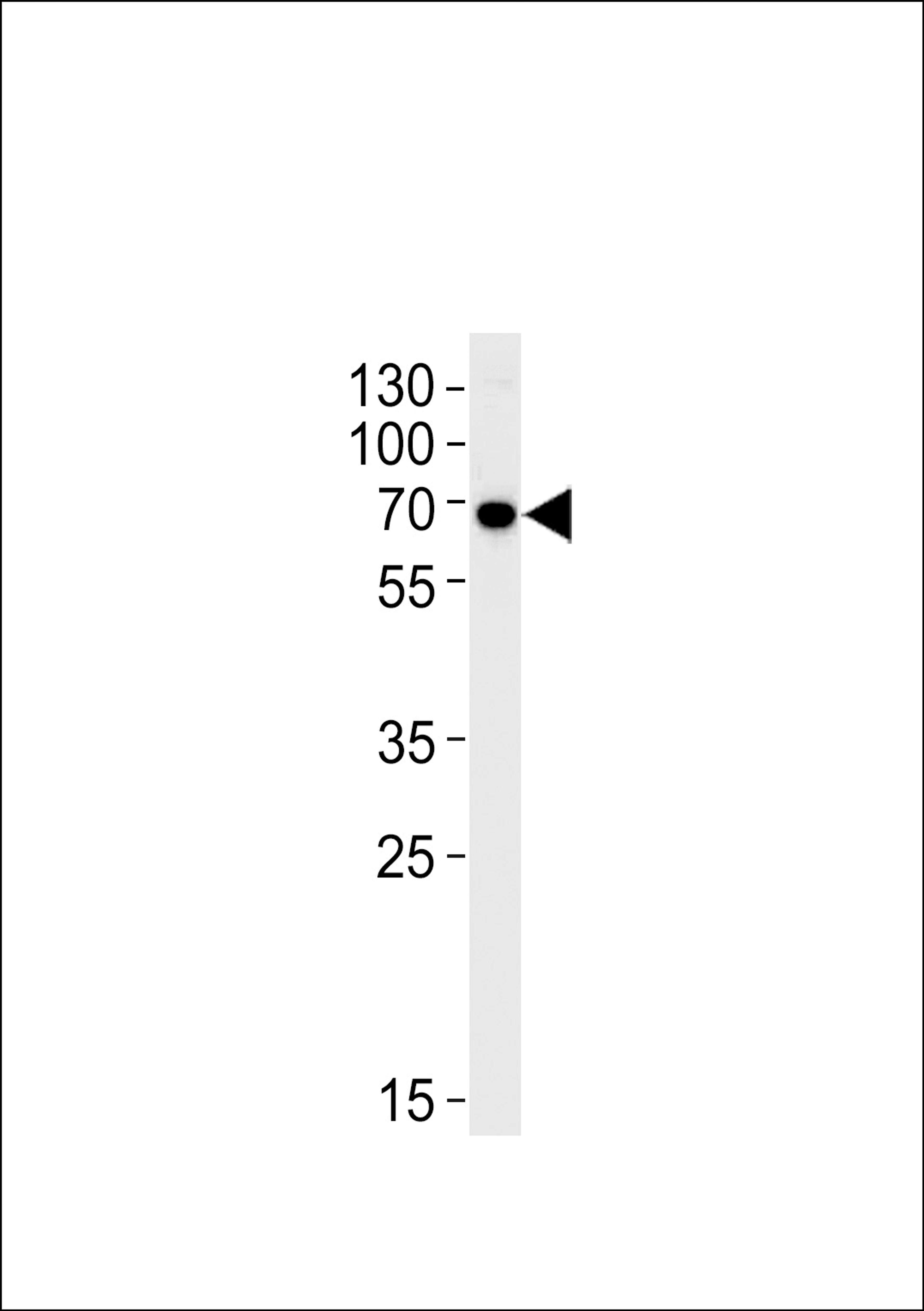 Western blot analysis in Hela cell line lysates (35ug/lane).