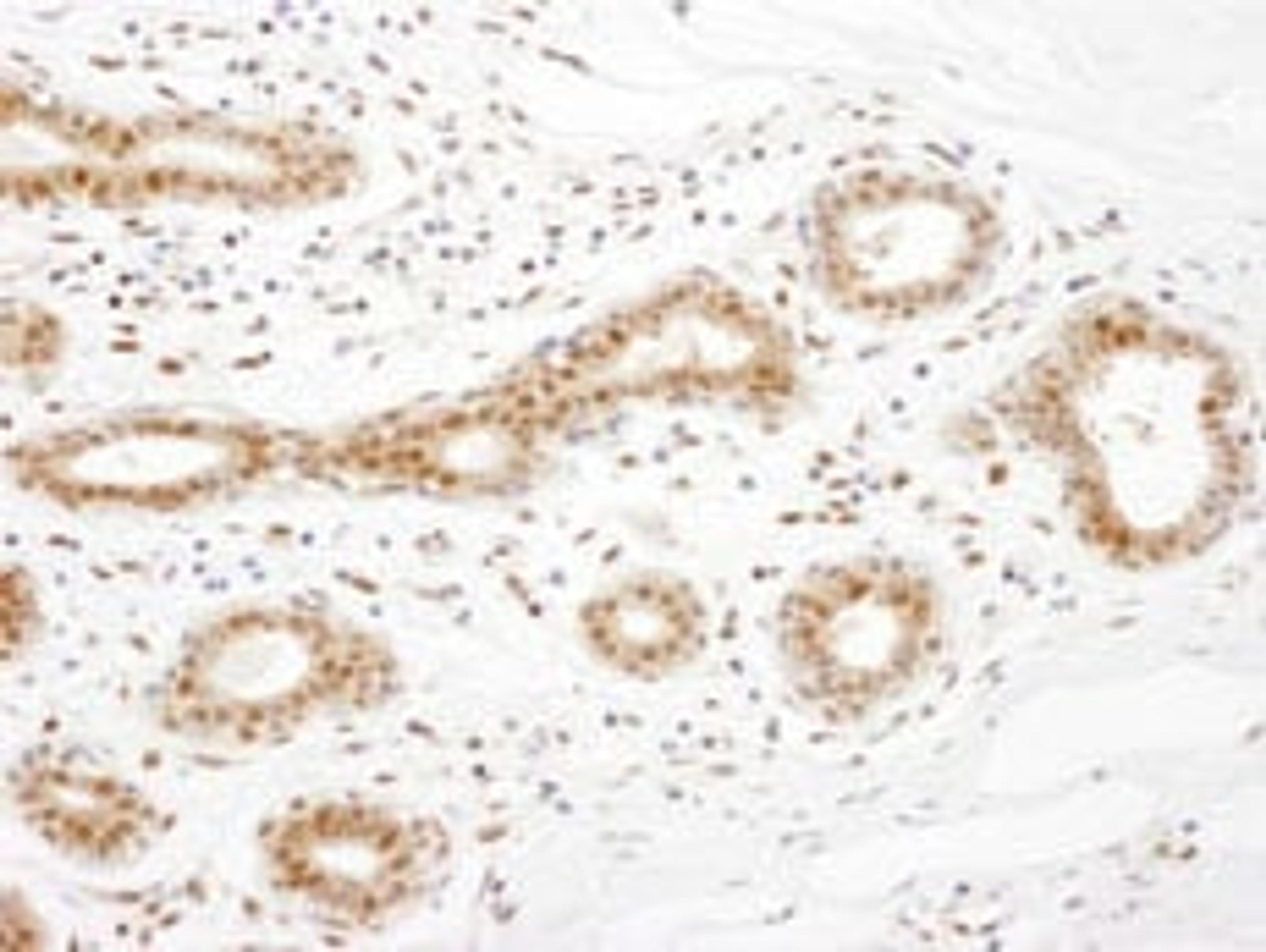 Detection of human TRAX by immunohistochemistry.