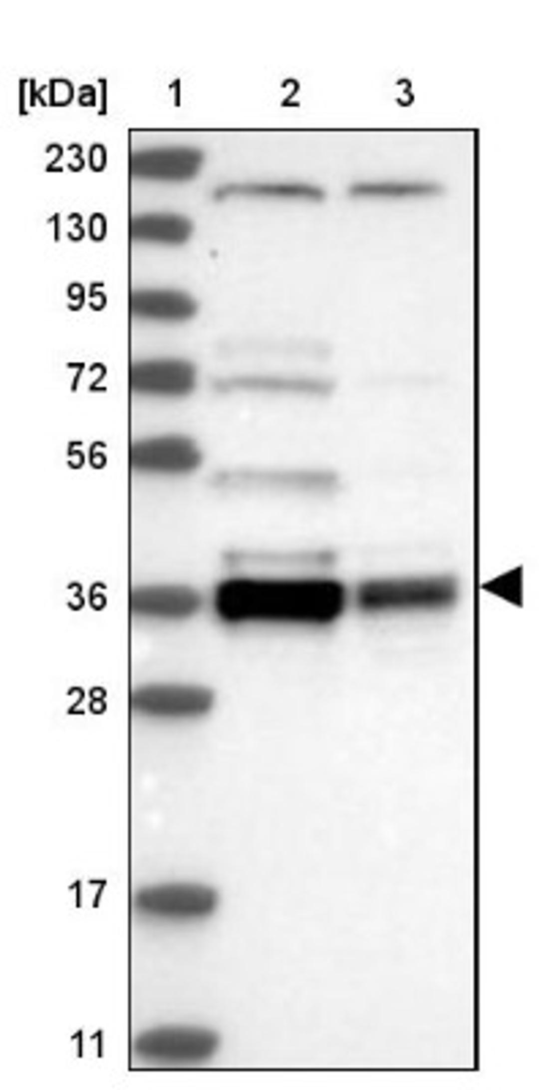 Western Blot: C1orf131 Antibody [NBP1-85097] - Lane 1: Marker [kDa] 230, 130, 95, 72, 56, 36, 28, 17, 11<br/>Lane 2: Human cell line RT-4<br/>Lane 3: Human cell line U-251MG sp