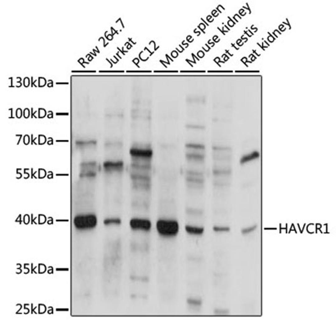 Western blot - HAVCR1 antibody (A2831)