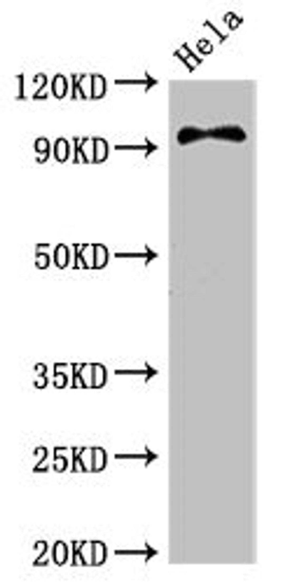 Western Blot. Positive WB detected in: Hela whole cell lysate. All lanes: PIK3C3 antibody at 3.4ug/ml. Secondary. Goat polyclonal to rabbit IgG at 1/50000 dilution. Predicted band size: 102 kDa. Observed band size: 102 kDa.