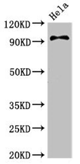 Western Blot. Positive WB detected in: Hela whole cell lysate. All lanes: PIK3C3 antibody at 3.4ug/ml. Secondary. Goat polyclonal to rabbit IgG at 1/50000 dilution. Predicted band size: 102 kDa. Observed band size: 102 kDa.