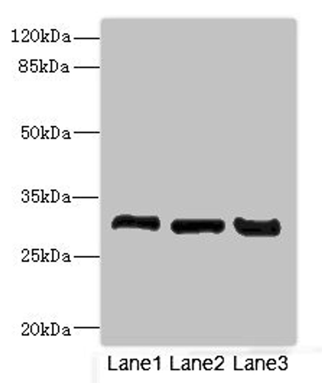 Western blot. All lanes: KHKantibody at 3.6ug/ml. Lane 1: Mouse liver tissue. Lane 2: Mouse kidney tissue. Lane 3: Rat kidney tissue. Secondary. Goat polyclonal to rabbit IgG at 1/10000 dilution. Predicted band size: 33 kDa. Observed band size: 33 kDa. 