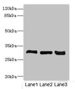 Western blot. All lanes: KHKantibody at 3.6ug/ml. Lane 1: Mouse liver tissue. Lane 2: Mouse kidney tissue. Lane 3: Rat kidney tissue. Secondary. Goat polyclonal to rabbit IgG at 1/10000 dilution. Predicted band size: 33 kDa. Observed band size: 33 kDa. 